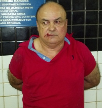 Ex-candidato a prefeito de Conceição do Lago Açu, Alexandre Lavepel.